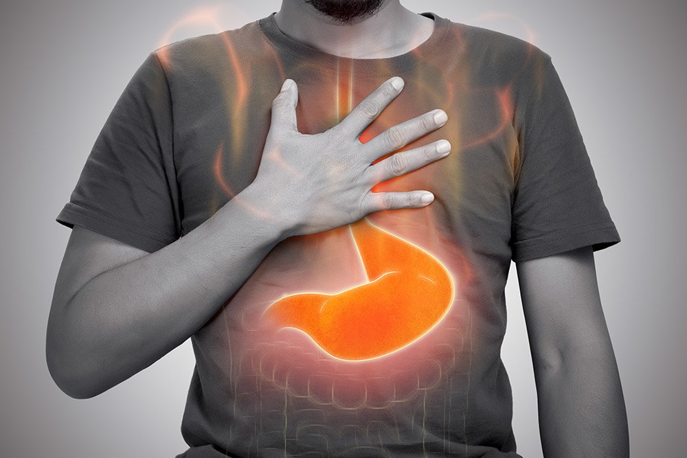 Kesehatan Lambung: Mengelola GERD dan Asam Lambung: Kunci Hidup Nyaman Tanpa Heartburn